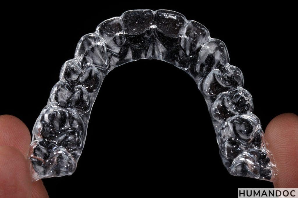 aligner, invisible aligner, orthodontics